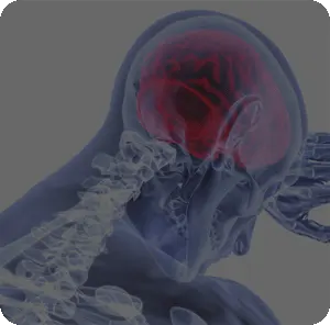 Grant, NM, Chiropractic Treatment of Headaches