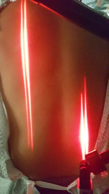 Laser Therapy in Grants, New Mexico